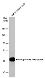 Anti-Dopamine Transporter antibody used in Western Blot (WB). GTX133152